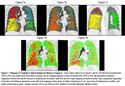 Progress  in Imaging COPD, 2004 - 2014