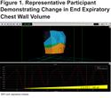 Quantification of Improvements in Static and Dynamic Ventilatory Measures Following Lung Volume Reduction Surgery for Severe COPD