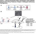 Patient-Derived Induced Pluripotent Stem Cells for Alpha-1 Antitrypsin Deficiency Disease Modeling and Therapeutic Discovery