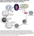 Patient-Derived Induced Pluripotent Stem Cells for Alpha-1 Antitrypsin Deficiency Disease Modeling and Therapeutic Discovery