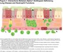 Neutrophil Modulation in Alpha-1 Antitrypsin Deficiency