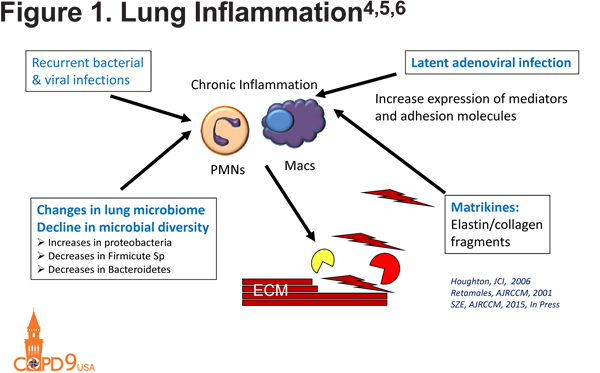 Pathophysiology of Emphysema  Journal of COPD Foundation